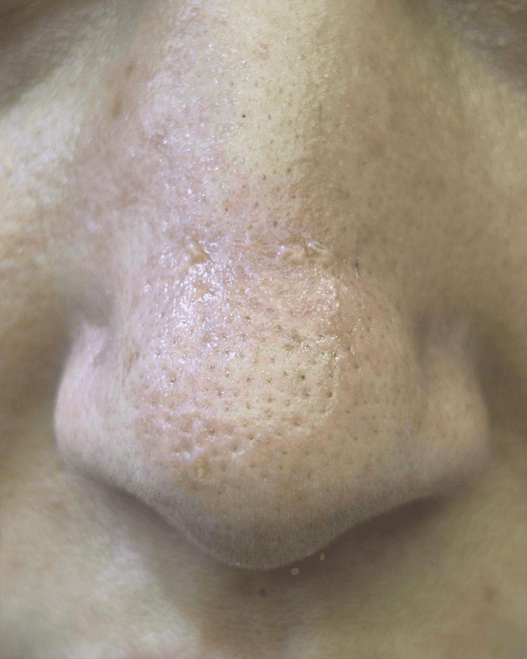 Before treatment