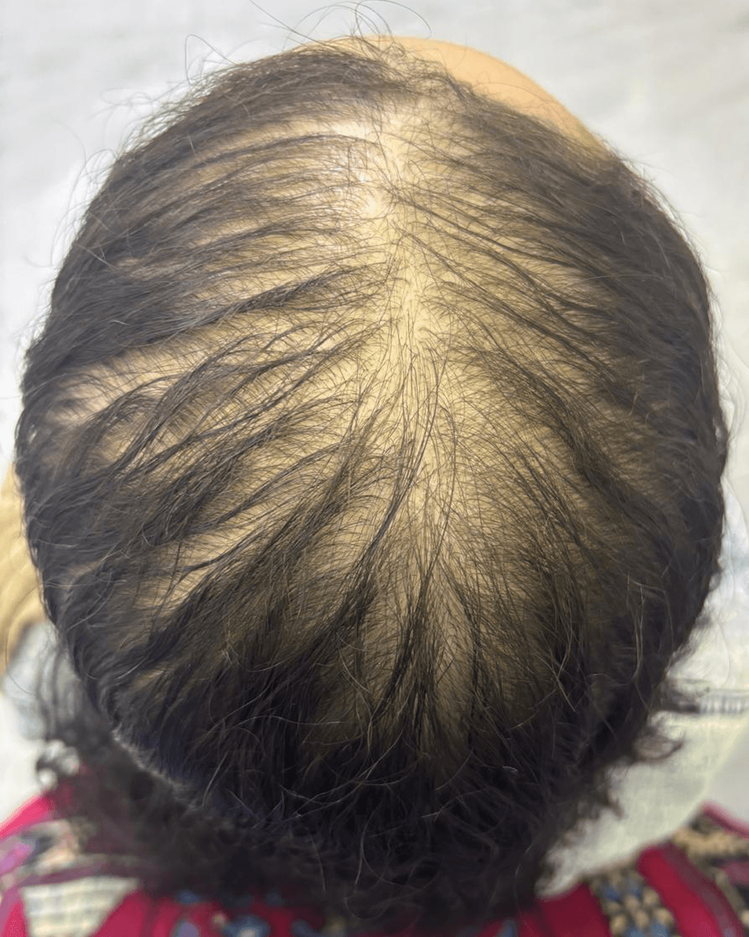 After treatment