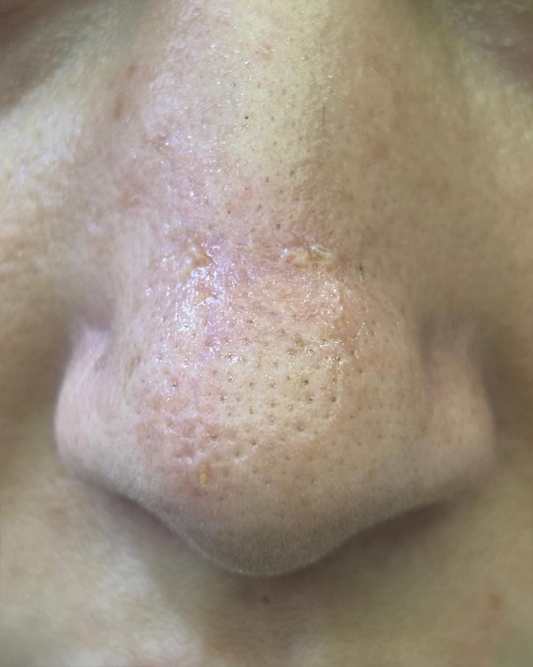 Before treatment